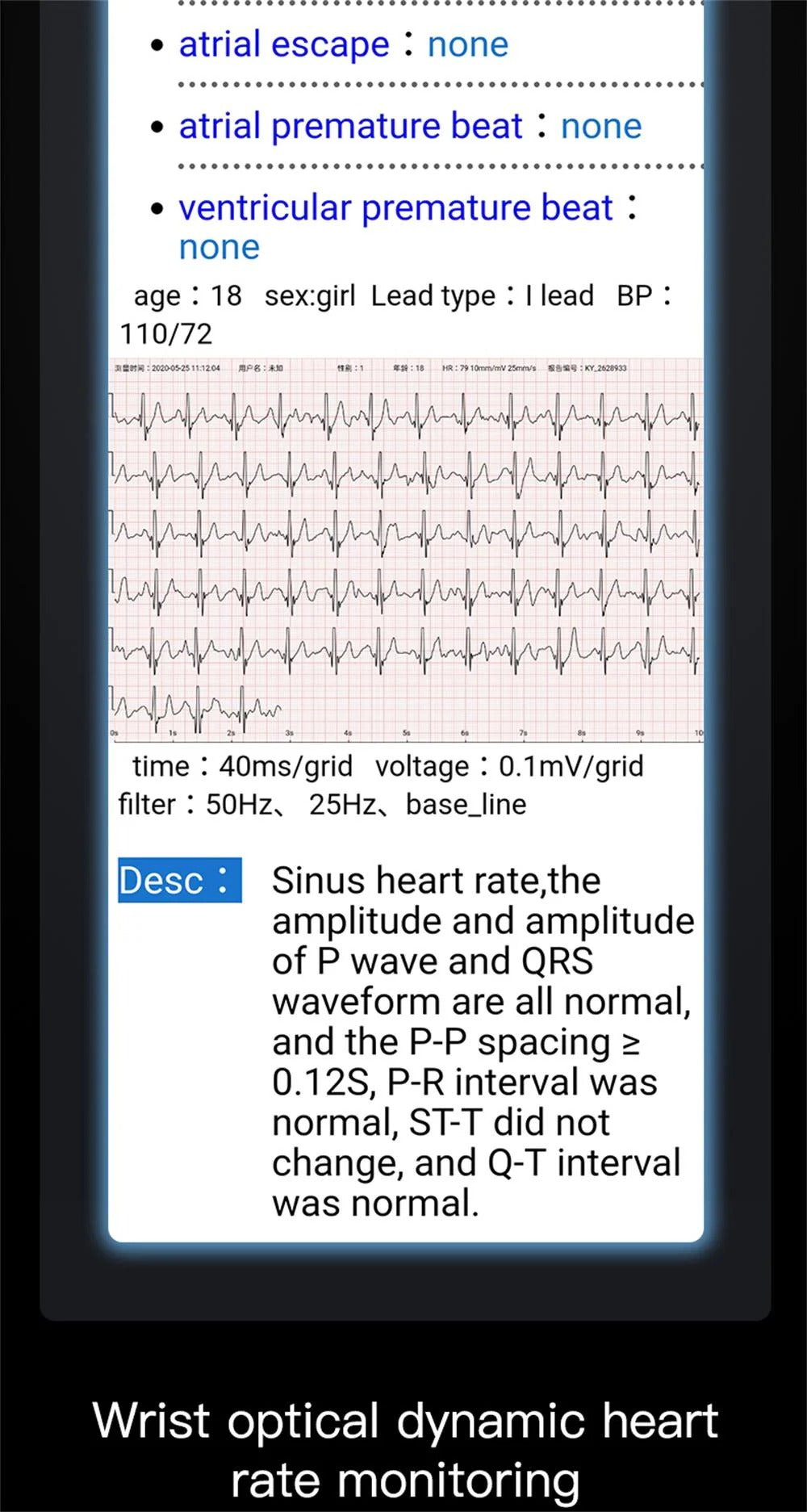 Marcus - Advanced Health Monitor Watch